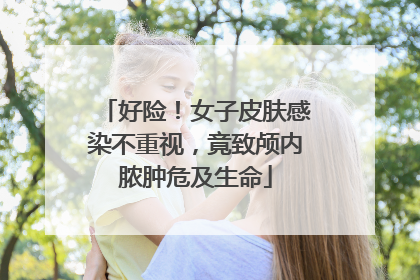 好险！女子皮肤感染不重视，竟致颅内脓肿危及生命